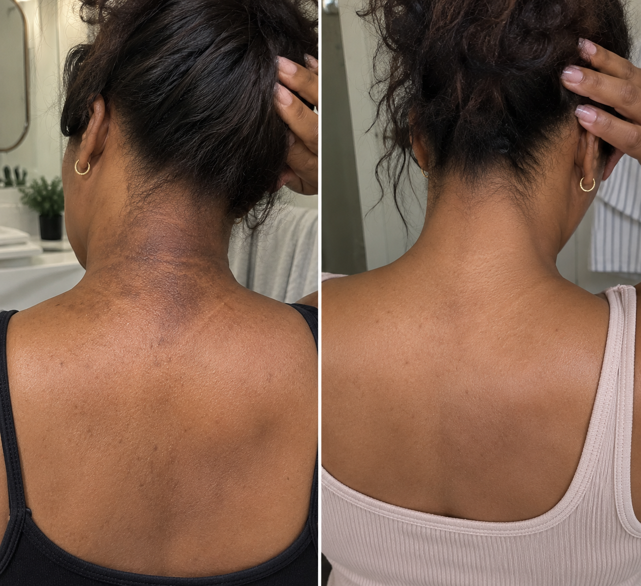 Before and after back of neck skincare result