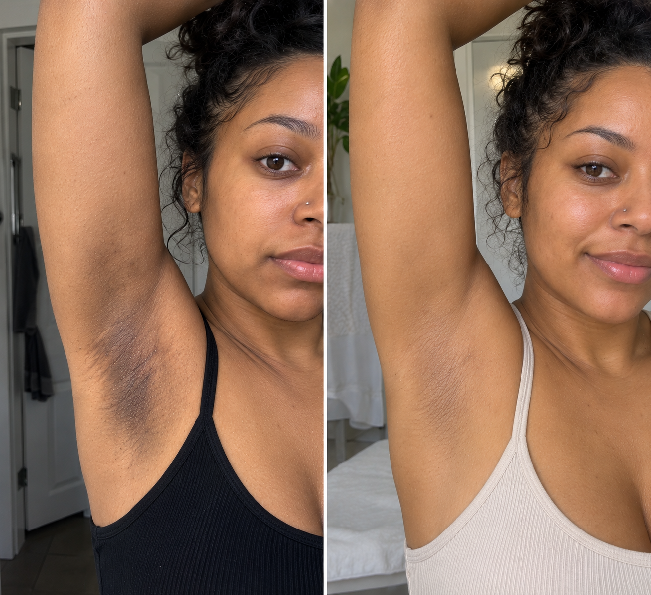 Before and after underarm uneven tone skincare result